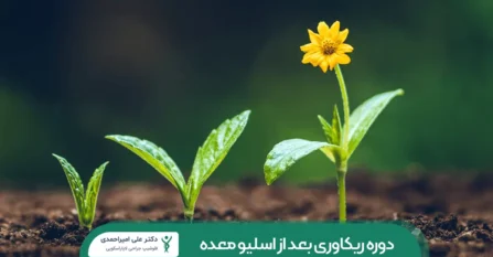 ریکاوری بعد از جراحی اسلیو معده شاخص