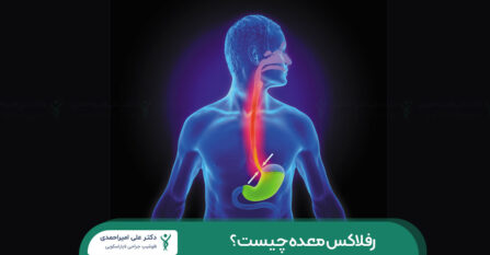 رفلاکس معده