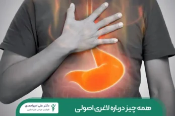 سوزش معده بعد از عمل اسلیو معده شاخص
